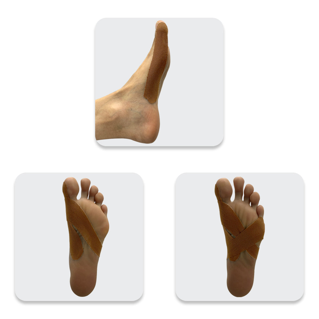 Beauty and the Bunion Box