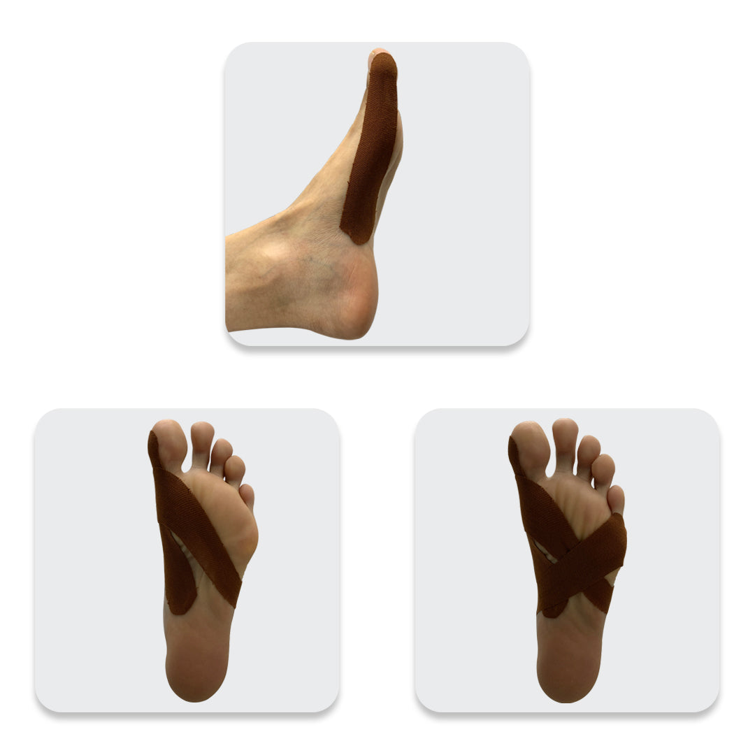 Beauty and the Bunion Box