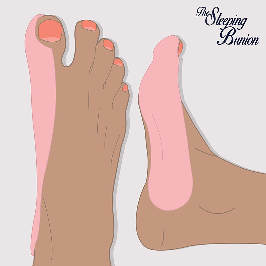 The Sleeping Bunion